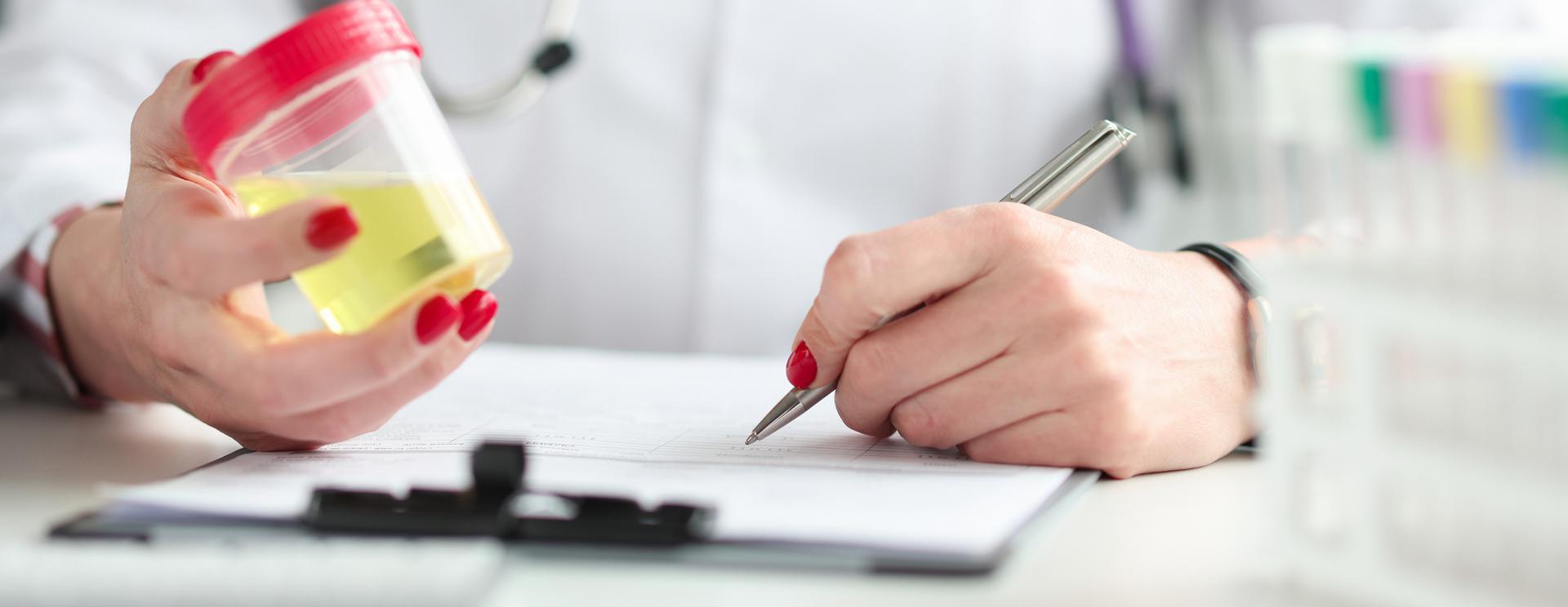 How Long Does CBD Oil Stay in Your System and Will It Show Up as THC on