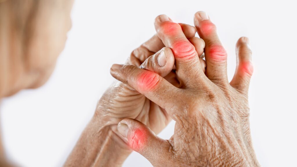 CBD oil for arthritis pain relief, CBD Oil and Arthritis: What You Should Know, Which form of CBD is best for pain?, Does CBD really work for pain?, What is the most trusted brand of CBD?, Does CBD help chronic pain in seniors?, What is the best CBD for seniors?, What is the current price for CBD?, How much CBD do you need for pain relief?, Does CBD show on a drug test?, How fast does CBD kick in for pain?, What are the side effects of CBD oil for the elderly?, What is the strongest CBD oil?, How much CBD should a senior take?, What are the risks of CBD oil?, What is the most effective brand of CBD gummies?,