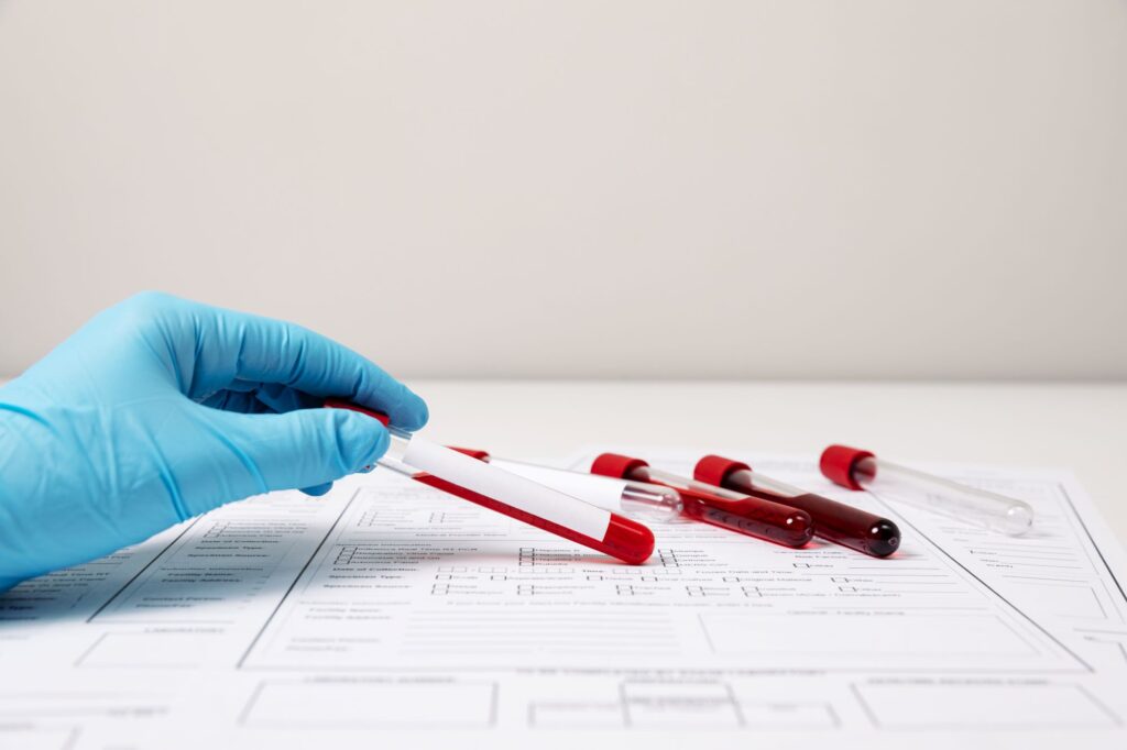 does cbd show up on routine blood work, cbd and blood tests, cbd and bloodwork, blood tests, cbd and blood tests,